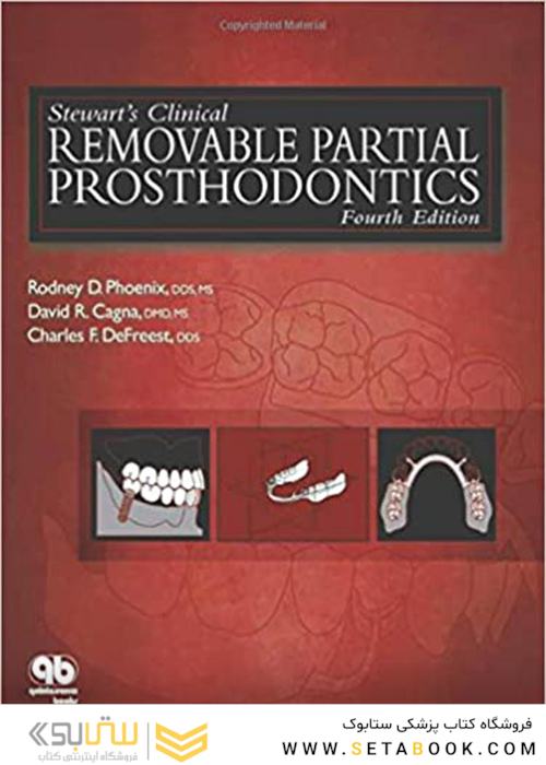 Stewart’s Clinical Removable Partial Prosthodontics 4th Edition2008 پروتزهای متحرک بالینی