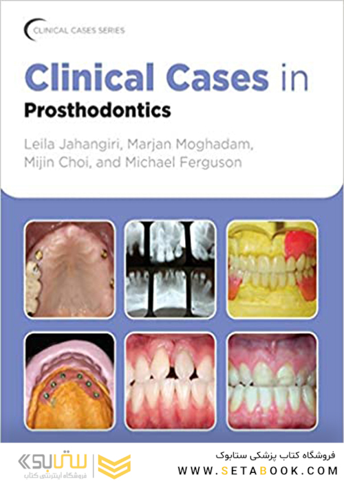 Clinical Cases in Prosthodontics 1st Edition2010 موارد بالینی در پروتزهای دندانی