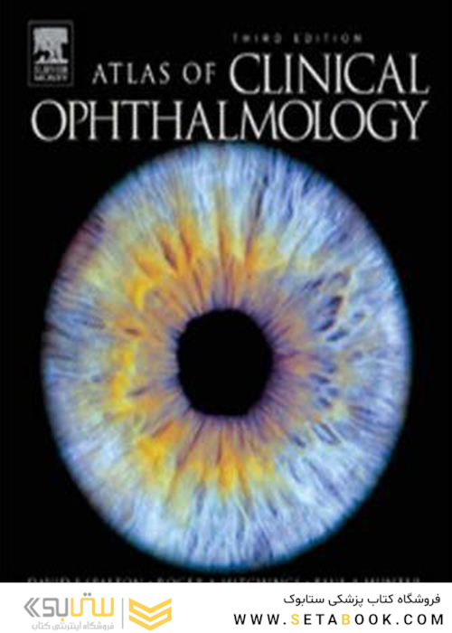 Atlas Of Clinical Ophthalmology 3rd Edition 2004