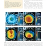 The Eye: Basic Sciences in Practice 4th Edition2015