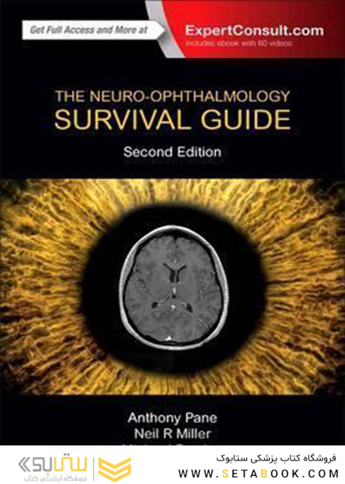 The Neuro-Ophthalmology Survival Guide 2nd Edition2017