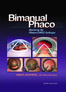 عکس Bimanual Phaco: Mastering the Phakonit/MICS Technique2004