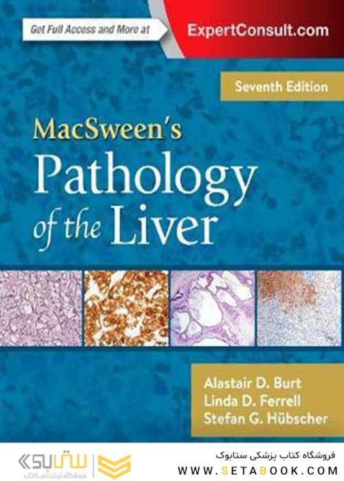 MacSween’s Pathology of the Liver 7th Edition2017 آسیب شناسی کبد