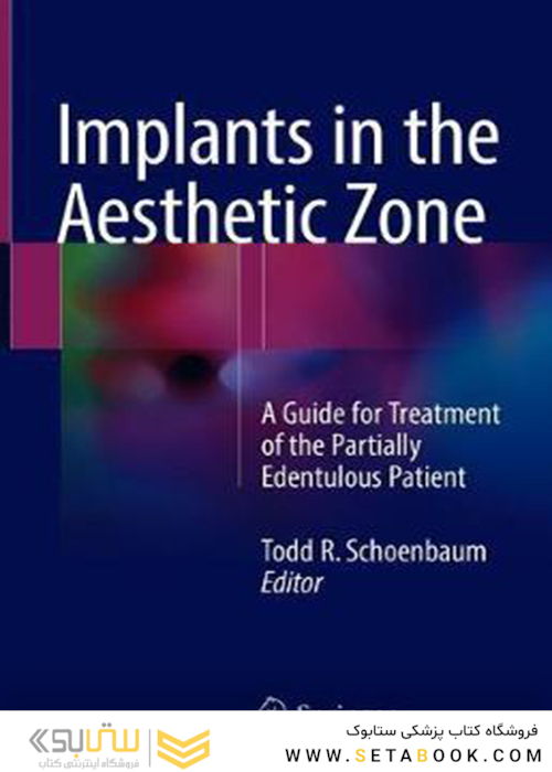 Implants in the Aesthetic Zone 1st Edition2018