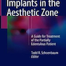 Implants in the Aesthetic Zone 1st Edition2018