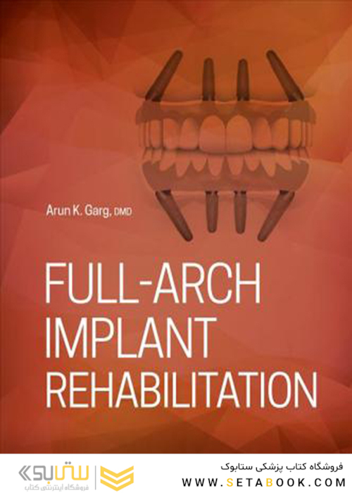 Full-Arch Implant Rehabilitation 1st Edition2019 توان بخشی کامل کاشت