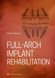 عکس Full-Arch Implant Rehabilitation 1st Edition2019 توان بخشی کامل کاشت