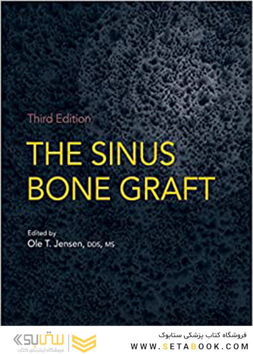 The Sinus Bone Graft 3rd Edition2019 پیوند استخوان سینوس