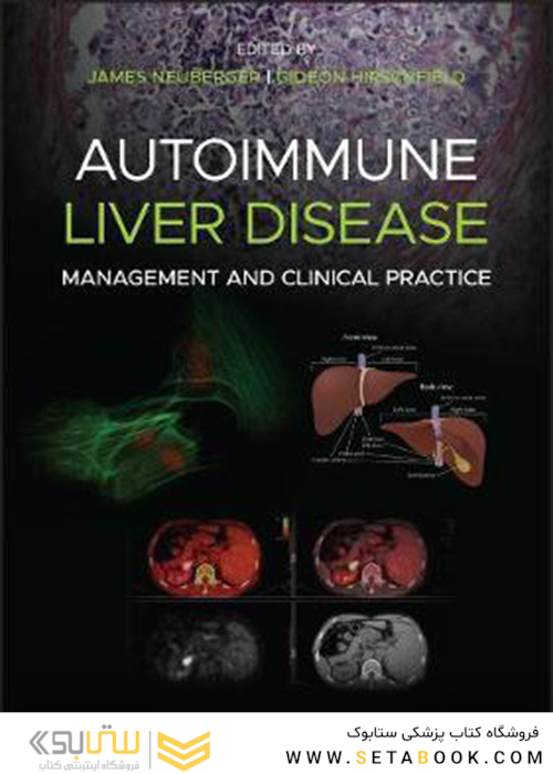 Autoimmune Liver Disease: Management and Clinical Practice2020 بیماری کبدی خود ایمنی: مدیریت و تمرین بالینی