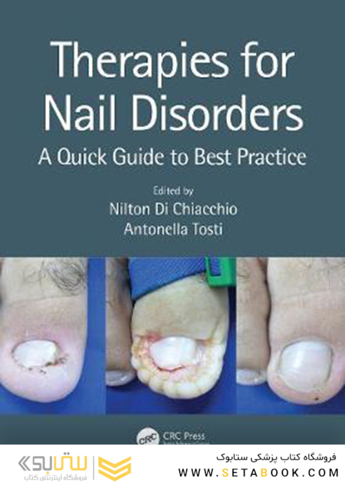 Therapies for Nail Disorders: A Quick Guide to Best Practice 2020
