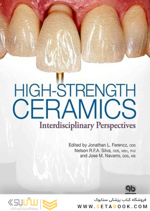High-Strength Ceramics 1st Edition2014 سرامیک ها با مقاومت بالا