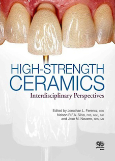 عکس High-Strength Ceramics 1st Edition2014 سرامیک ها با مقاومت بالا
