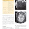 Odell’s Clinical Problem Solving in Dentistry 4th Edition2020