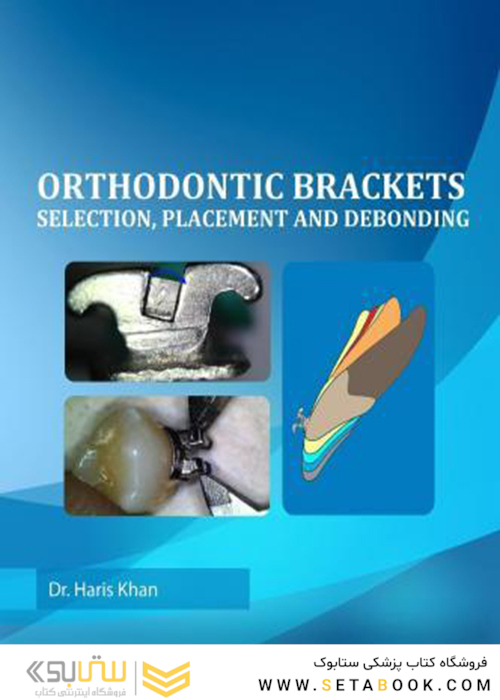 Orthodontic Brackets: Selection,Placement and Debonding2015 براکت های ارتودنسی: انتخاب ، جاگذاری و رد کردن