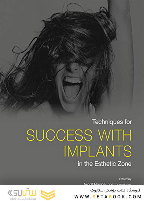 Techniques for Success With Implants in the Esthetic Zone2019