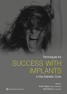 عکس Techniques for Success With Implants in the Esthetic Zone2019