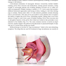 Botulinum Toxin Treatment: What Everyone Should Know
