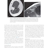 Musculoskeletal MRI 3rd Edition2019