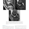 Musculoskeletal MRI 3rd Edition2019