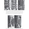 Musculoskeletal MRI 3rd Edition2019
