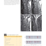 Musculoskeletal MRI 3rd Edition2019