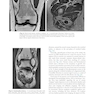 Musculoskeletal MRI 3rd Edition2019