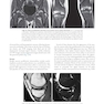Musculoskeletal MRI 3rd Edition2019