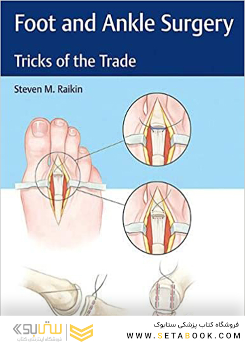 Foot and Ankle Surgery: Tricks of the Trade2018 جراحی پا و مچ پا