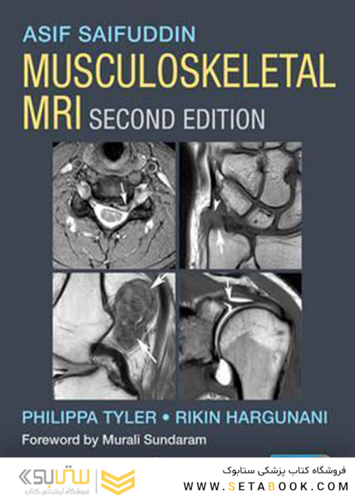 Musculoskeletal MRI 2nd Edition2016 عضله اسکلتی عضلانی نسخه 2