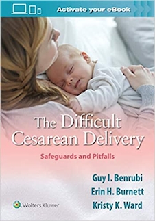 عکس The Difficult Cesarean Delivery: Safeguards and Pitfalls2020 زایمان سزارین دشوار: پادمان ها و مشکلات