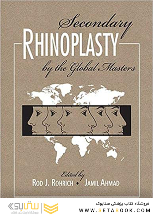Secondary Rhinoplasty by the Global Masters 2017