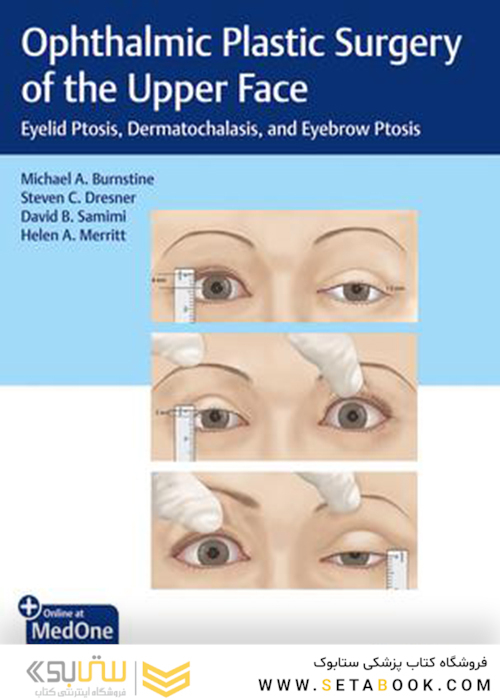 Ophthalmic Plastic Surgery of the Upper Face2019 جراحی پلاستیک چشم از قسمت فوقانی صورت
