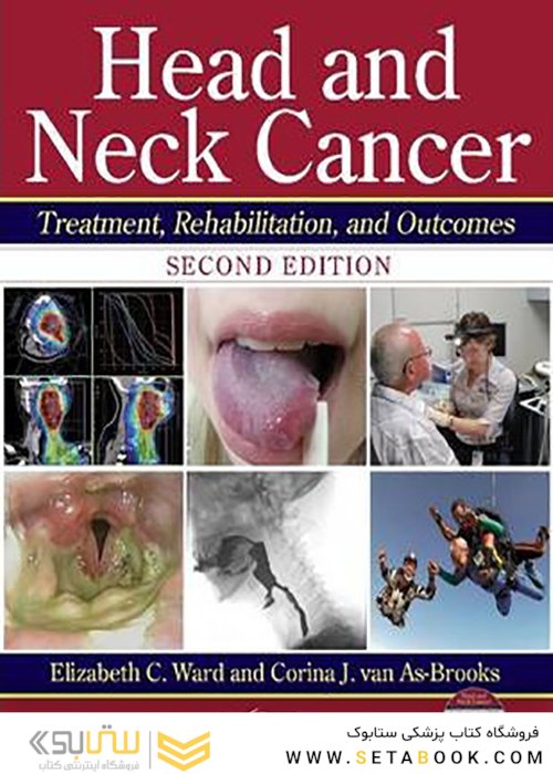 Head and Neck Cancer Second Edition2014 سرطان گردن و سر