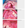 Color Atlas of Oral Diseases: Diagnosis and Treatment 4th Edicion 2017