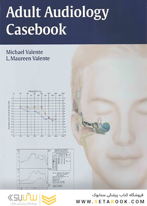 Adult Audiology Casebook 1st Edition2015 موردی شنوایی شناسی بزرگسالان
