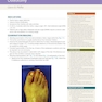 Operative Techniques: Foot and Ankle Surgery 2nd Edition2017