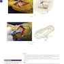 Operative Techniques: Foot and Ankle Surgery 2nd Edition2017