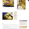 Operative Techniques: Foot and Ankle Surgery 2nd Edition2017