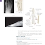 Operative Techniques: Foot and Ankle Surgery 2nd Edition2017