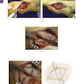 Operative Techniques: Foot and Ankle Surgery 2nd Edition2017