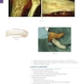 Operative Techniques: Foot and Ankle Surgery 2nd Edition2017