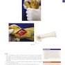 Operative Techniques: Foot and Ankle Surgery 2nd Edition2017