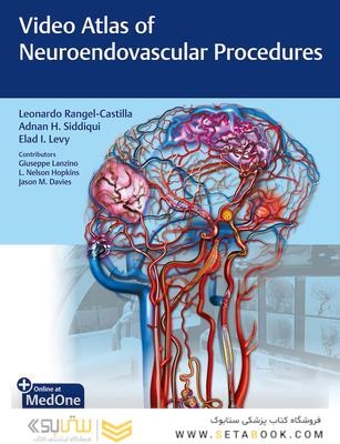 Video Atlas of Neuroendovascular Procedures 1st Edition2020 اطلس ویدئویی روشهای عصبی