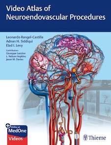 عکس Video Atlas of Neuroendovascular Procedures 1st Edition2020 اطلس ویدئویی روشهای عصبی
