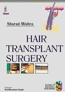 عکس Hair Transplant Surgery 1st Edition 2014