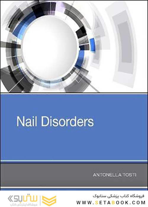 Nail Disorders 1st Edition 2018