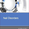 Nail Disorders 1st Edition 2018
