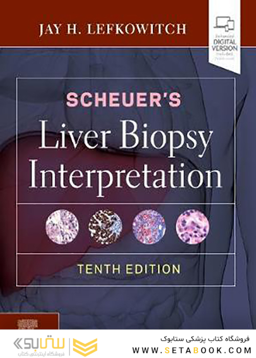 Scheuer’s Liver Biopsy Interpretation 10th Edition 2020