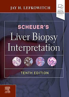 عکس Scheuer’s Liver Biopsy Interpretation 10th Edition 2020