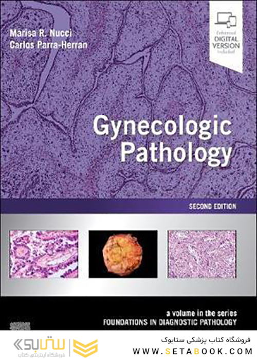 Gynecologic Pathology, 2nd Edition2020